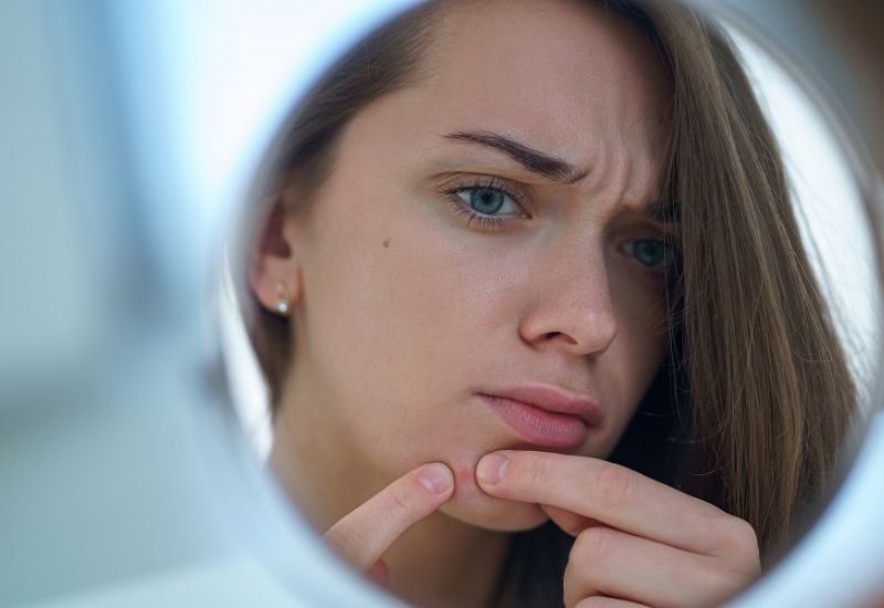 Why Am I Breaking Out? 4 Main Causes of Pimples for Teens