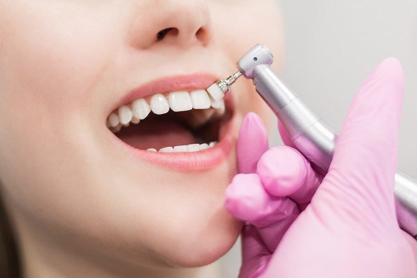 Why You Should Visit the Dentist if You Haven’t Gone Recently