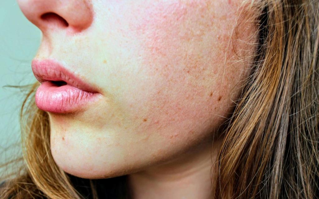 Skin Issues You Should Get Ahead of While You’re Young